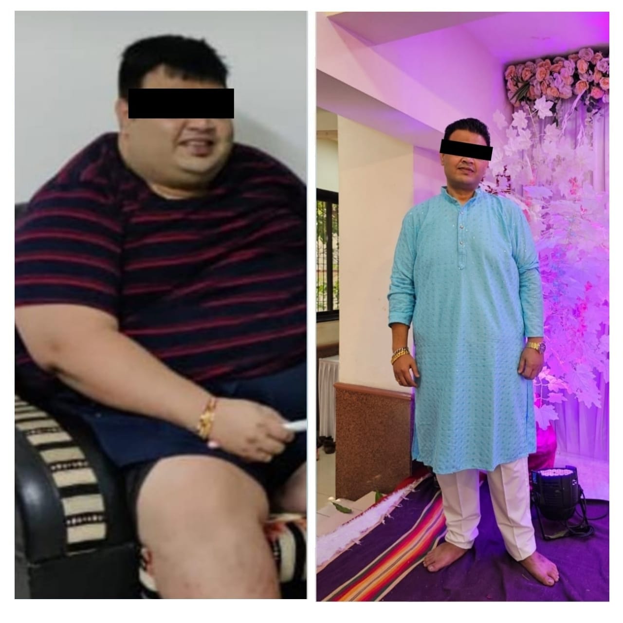 Jupiter Hospital Bariatric Surgery Before and After -2