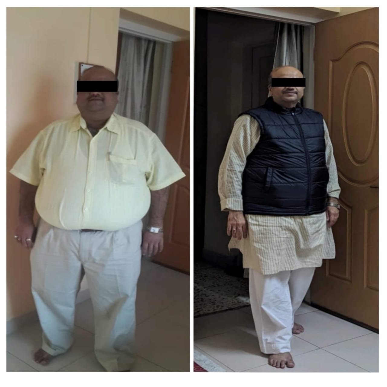 Jupiter Hospital Bariatric Surgery Before and After -4