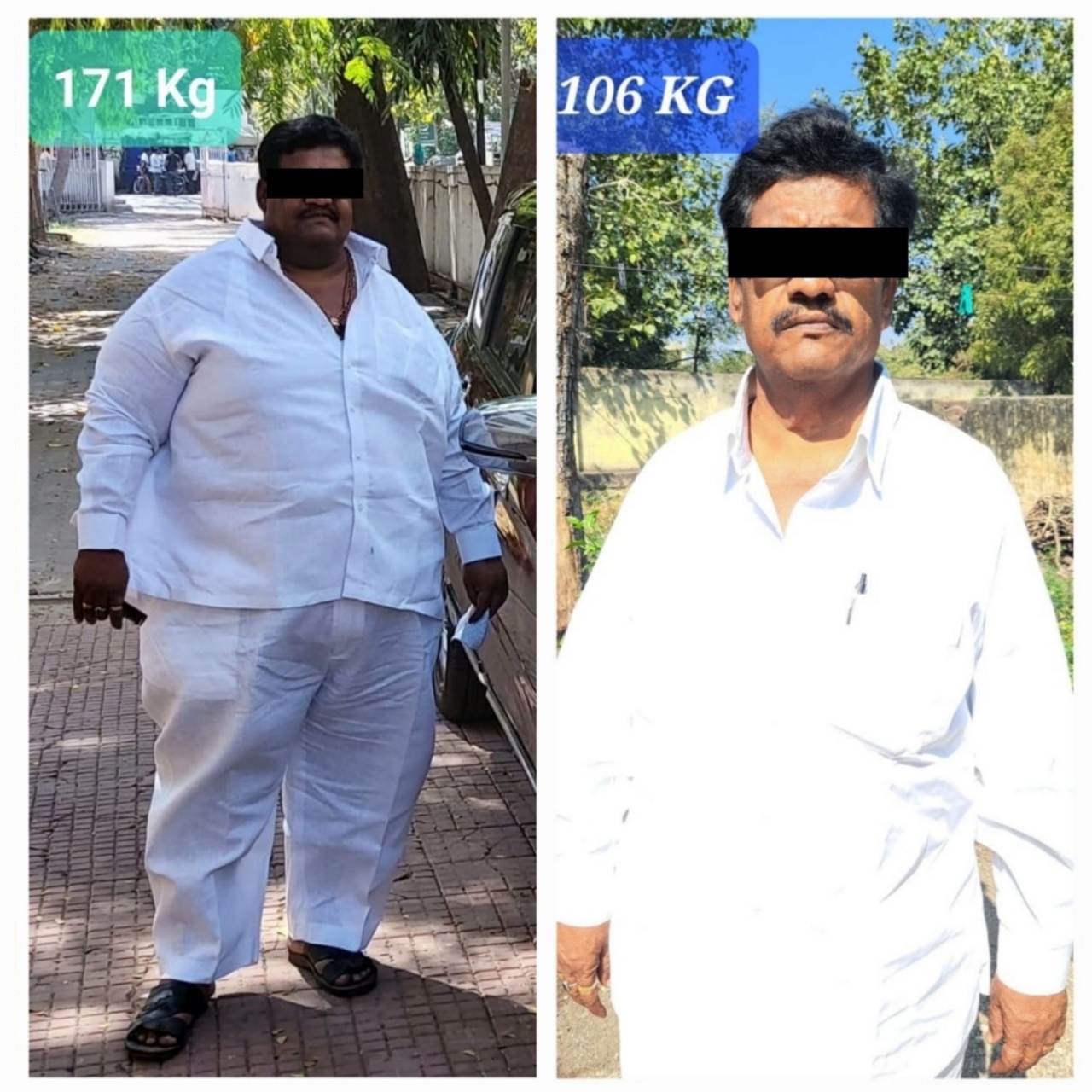 Jupiter Hospital - Bariatric Surgery Before and After photo -2